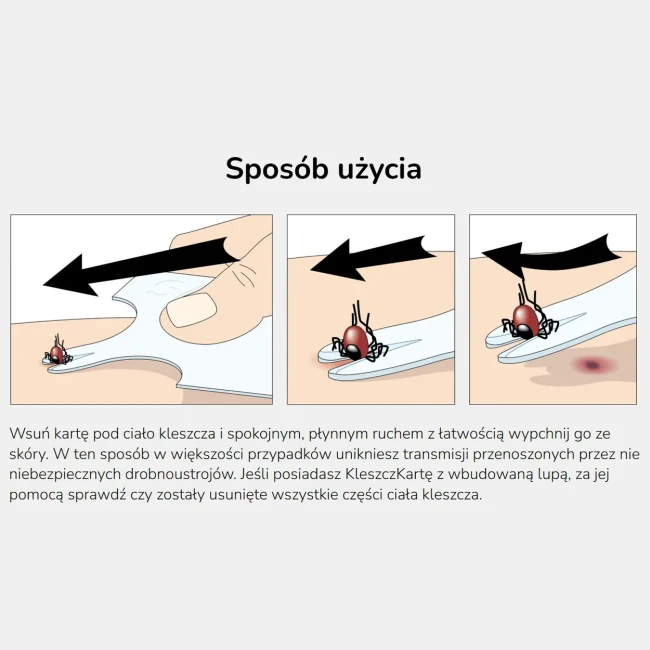 kleszczkarta-safecard-karta-do-bezpiecznego-usuwania-kleszczy-przezroczysta.jpeg